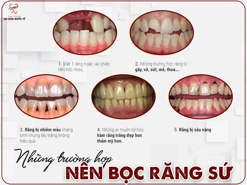 Hệ thống nha khoa sài gòn quốc tế